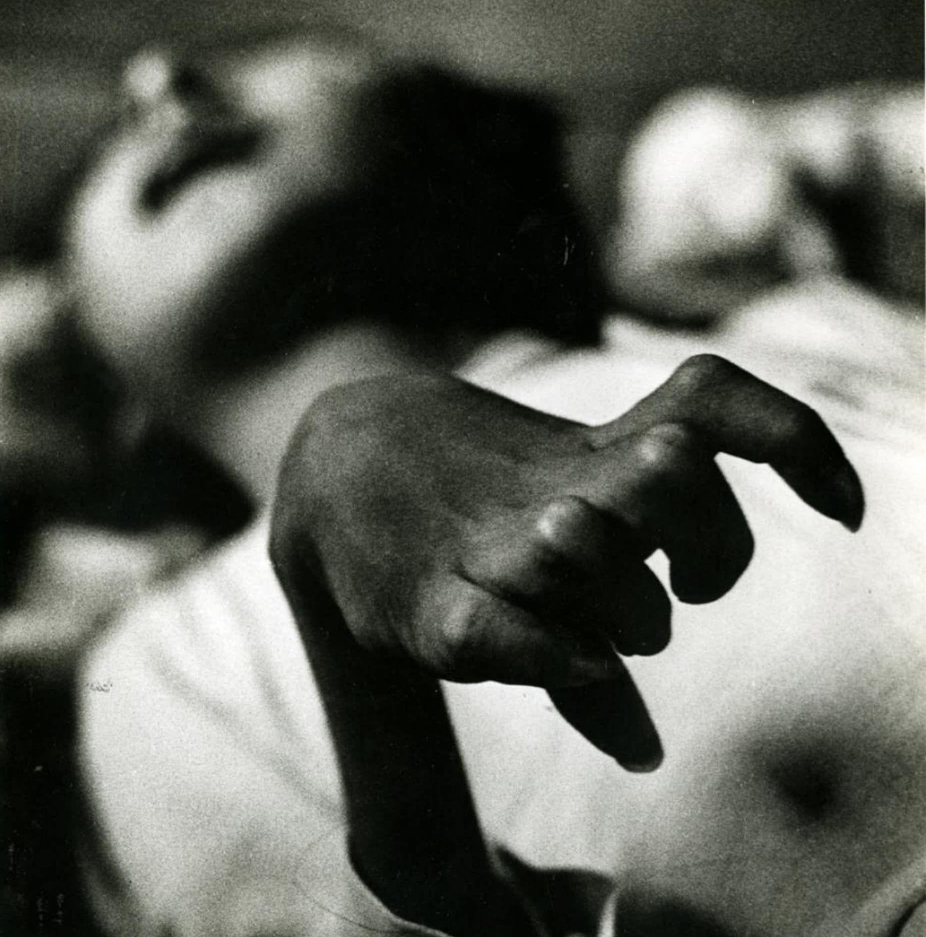 W. Eugene Smith. Iwazu Funaba's Crippled Hand, Minamata, 1971